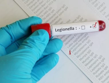 Νόσος των Λεγεωνάριων: Προσοχή στα συμπτώματα της ασθένειας από τα air condition